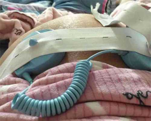 试管婴儿微刺激方案费用差异解析